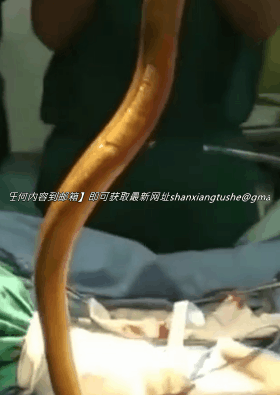 图片[5]-【特殊资源】当年火遍全网的黄鳝门事件，相信大家都看过了-uu欢迎您！